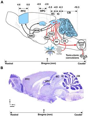 Delving into the significance of the His289Tyr single-nucleotide polymorphism in the glutamate ionotropic receptor kainate-1 (Grik1) gene of a genetically audiogenic seizure model